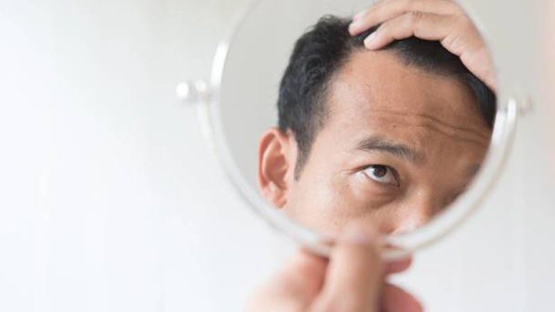 cara mengatasi rambut rontok