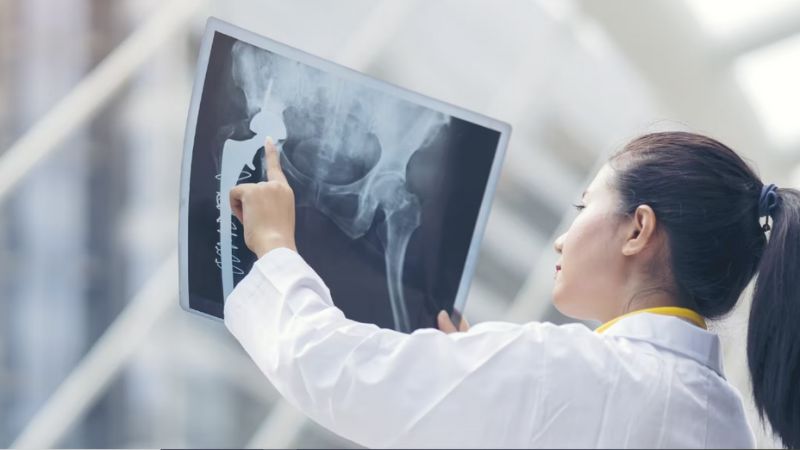 petugas medis melihat hasil rongten tulang